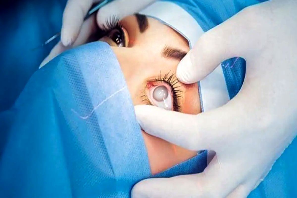 Cataract-Surgery-FAQs-–-All-You-Need-to-Know-Beforehand-mHospital